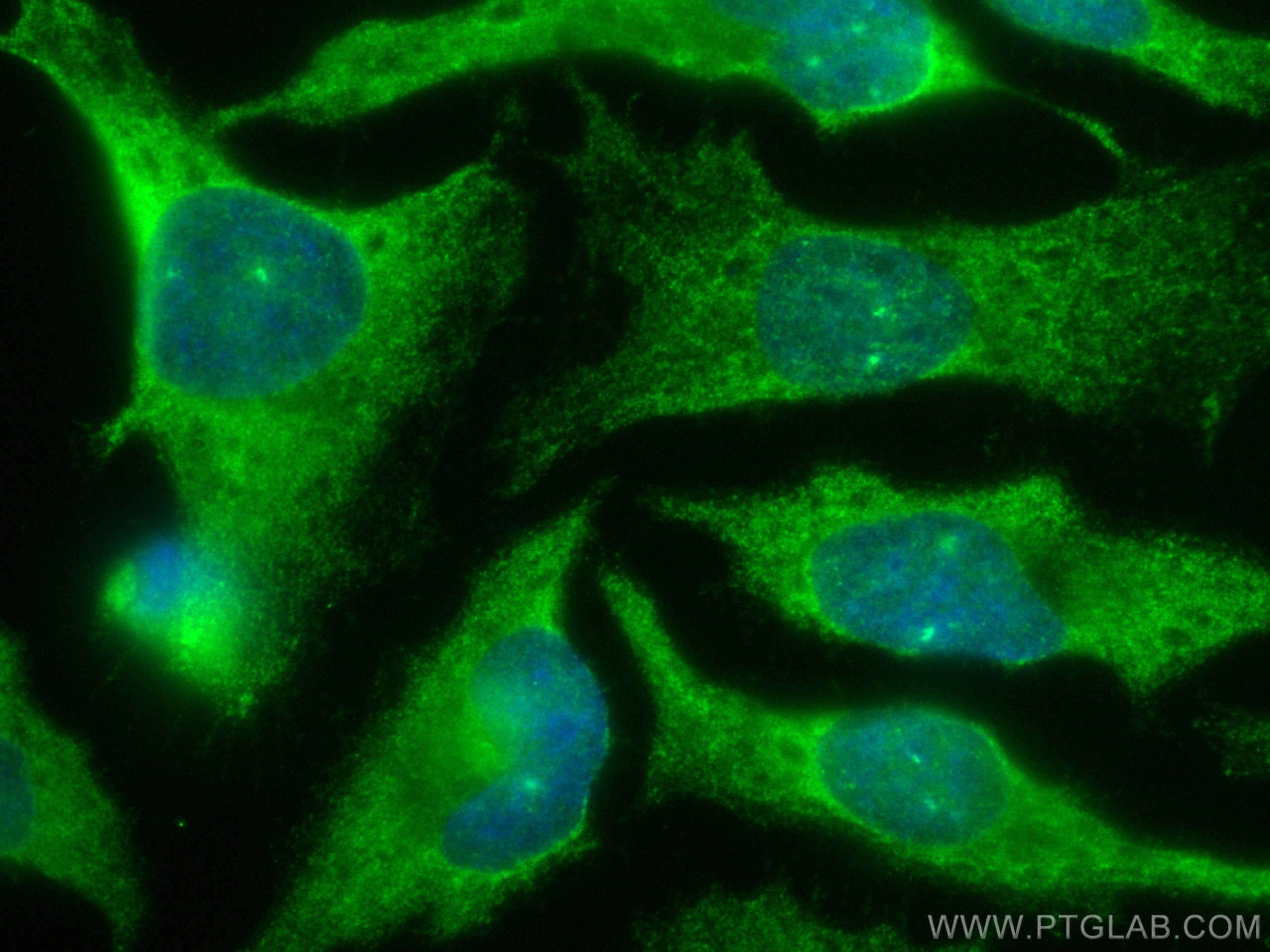 IF Staining of HeLa using CL488-67686