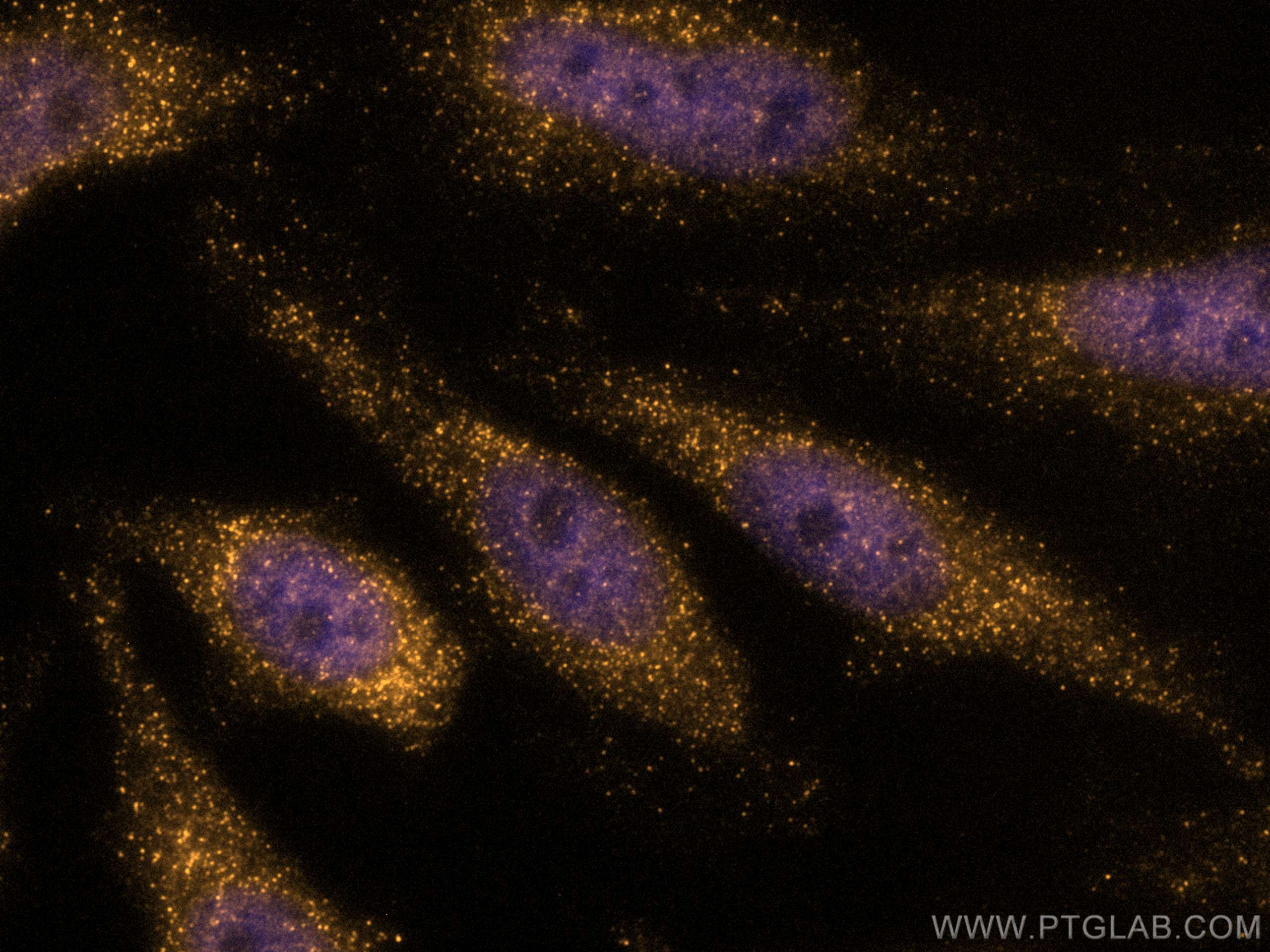 Immunofluorescence (IF) / fluorescent staining of HeLa cells using CoraLite®555-conjugated cyclin B1 Monoclonal antib (CL555-67686)