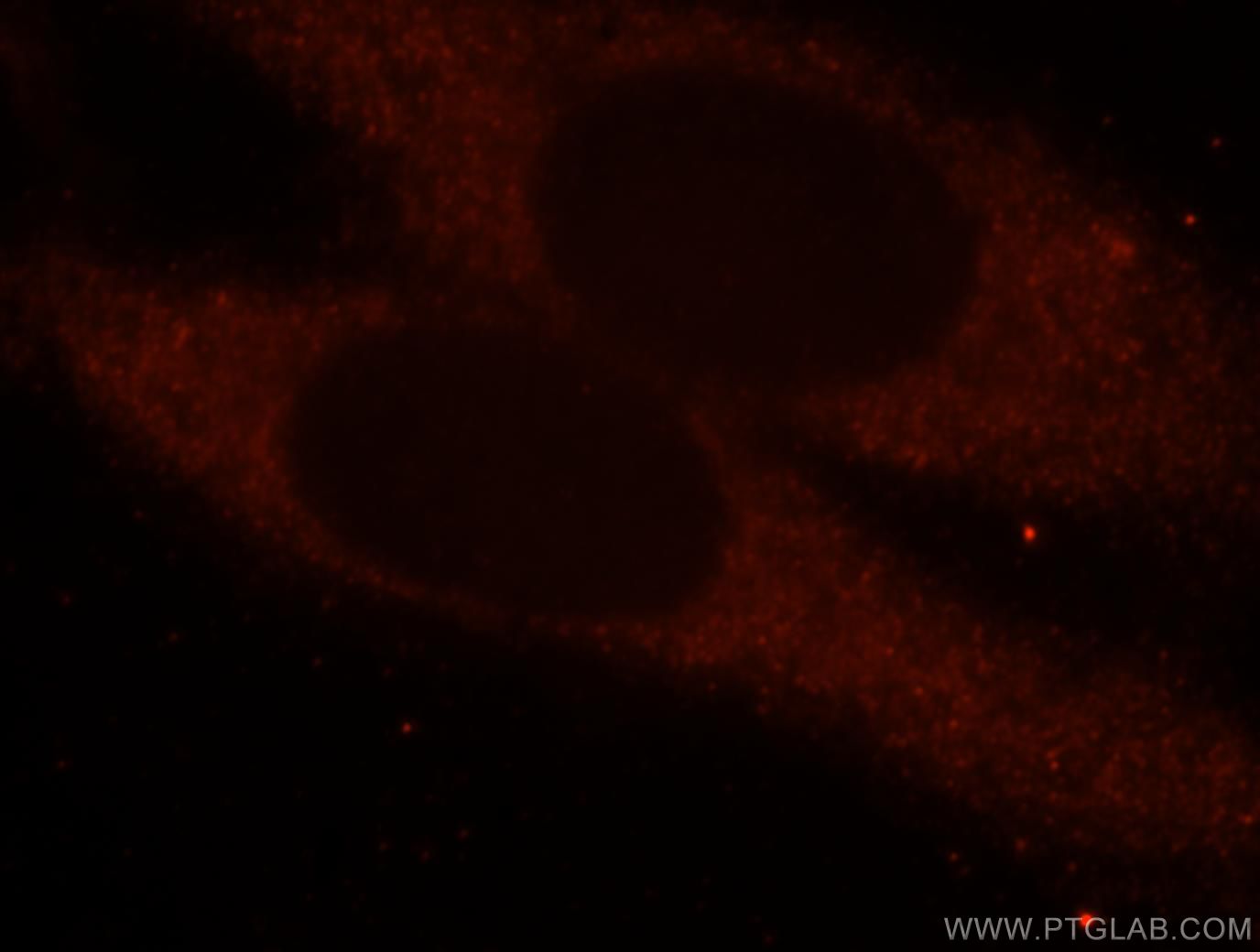 Immunofluorescence (IF) / fluorescent staining of HepG2 cells using domain-I-of-FIZ-1 Polyclonal antibody (15826-1-AP)