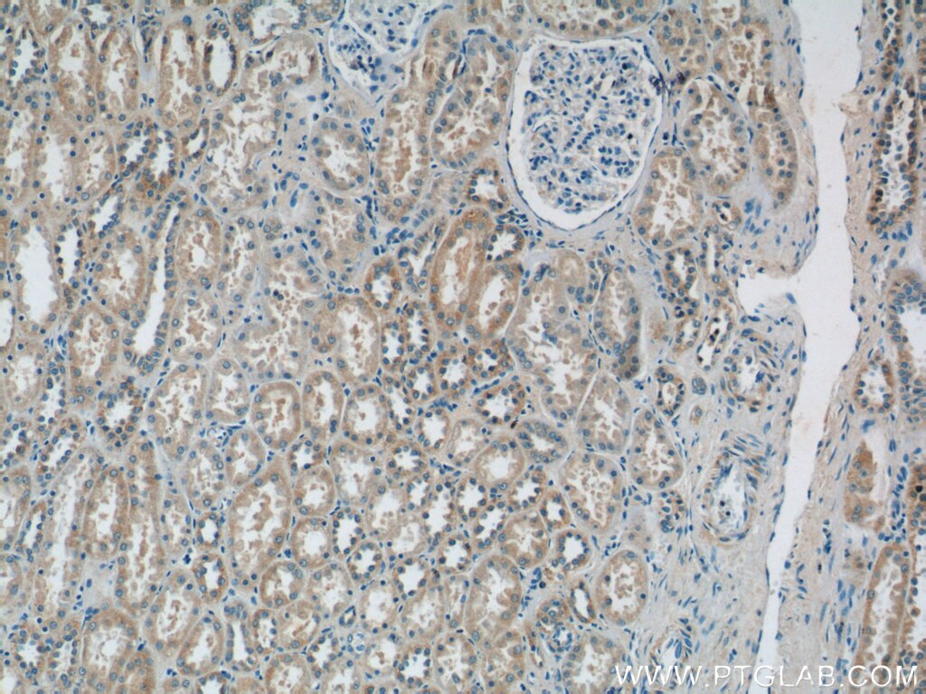 Immunohistochemistry (IHC) staining of human kidney tissue using domain-I-of-FIZ-1 Polyclonal antibody (15826-1-AP)