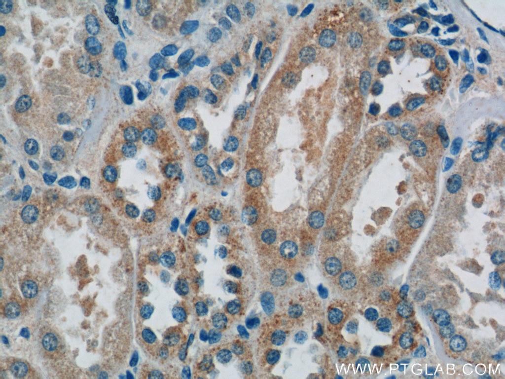 Immunohistochemistry (IHC) staining of human kidney tissue using domain-I-of-FIZ-1 Polyclonal antibody (15826-1-AP)