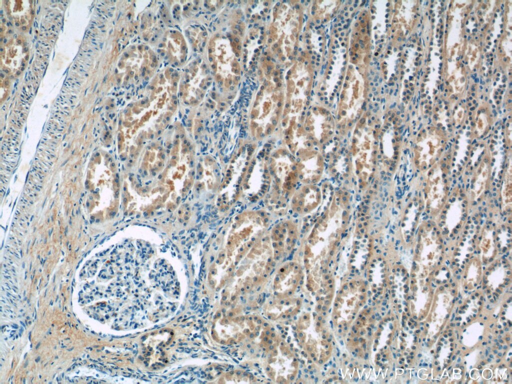 Immunohistochemistry (IHC) staining of human kidney tissue using domain-I-of-FIZ-1 Polyclonal antibody (15826-1-AP)