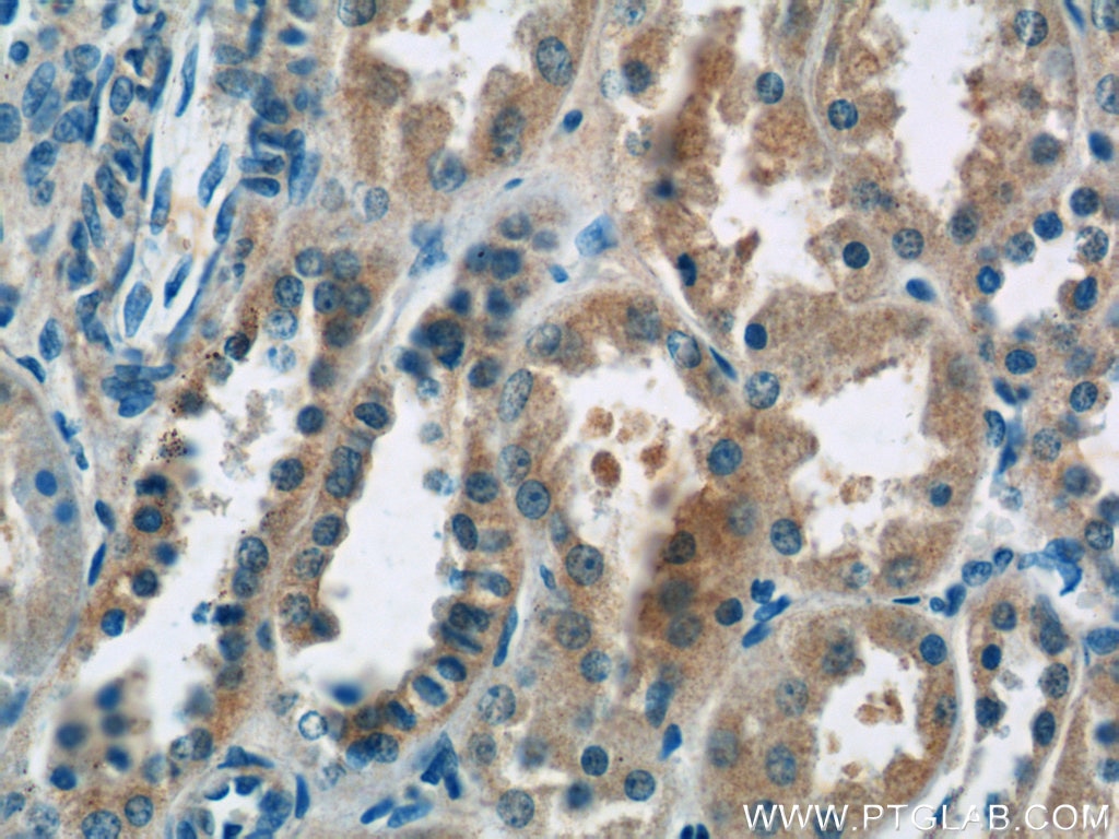 Immunohistochemistry (IHC) staining of human kidney tissue using domain-I-of-FIZ-1 Polyclonal antibody (15826-1-AP)