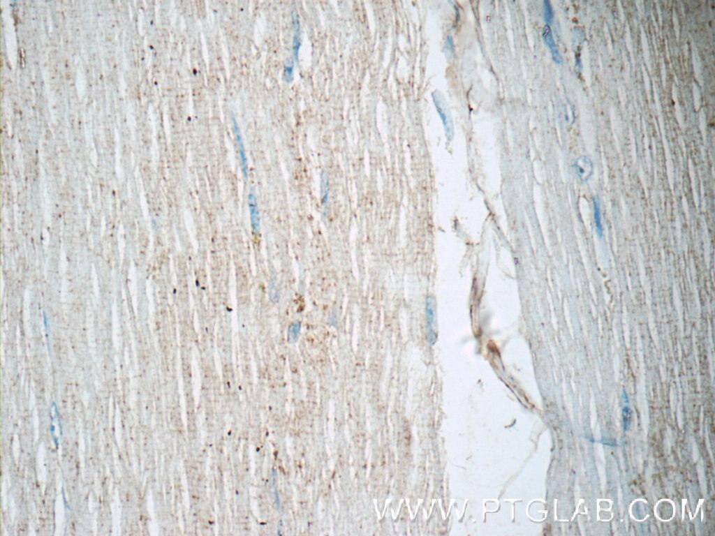 IHC staining of human skeletal muscle using 15826-1-AP
