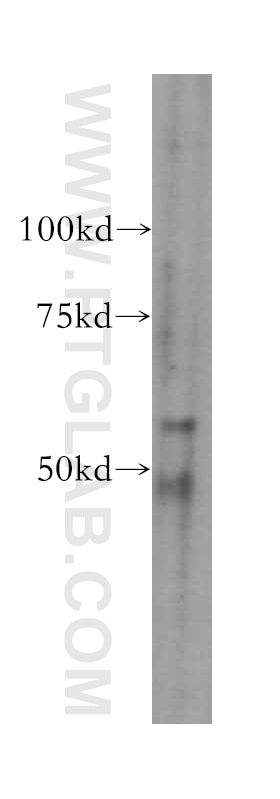 Western Blot (WB) analysis of Y79 cells using domain-I-of-FIZ-1 Polyclonal antibody (15826-1-AP)