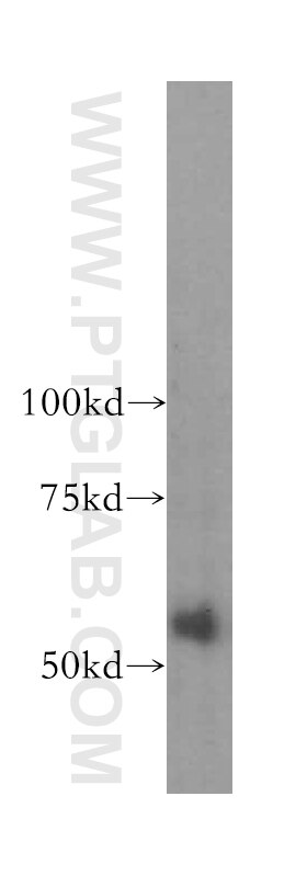 WB analysis of human kidney using 15826-1-AP