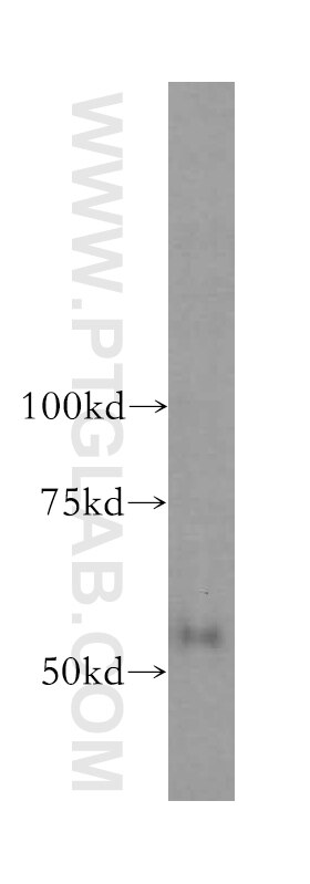 Western Blot (WB) analysis of human kidney tissue using domain-I-of-FIZ-1 Polyclonal antibody (15826-1-AP)