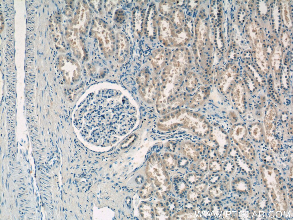 IHC staining of human kidney using 15827-1-AP