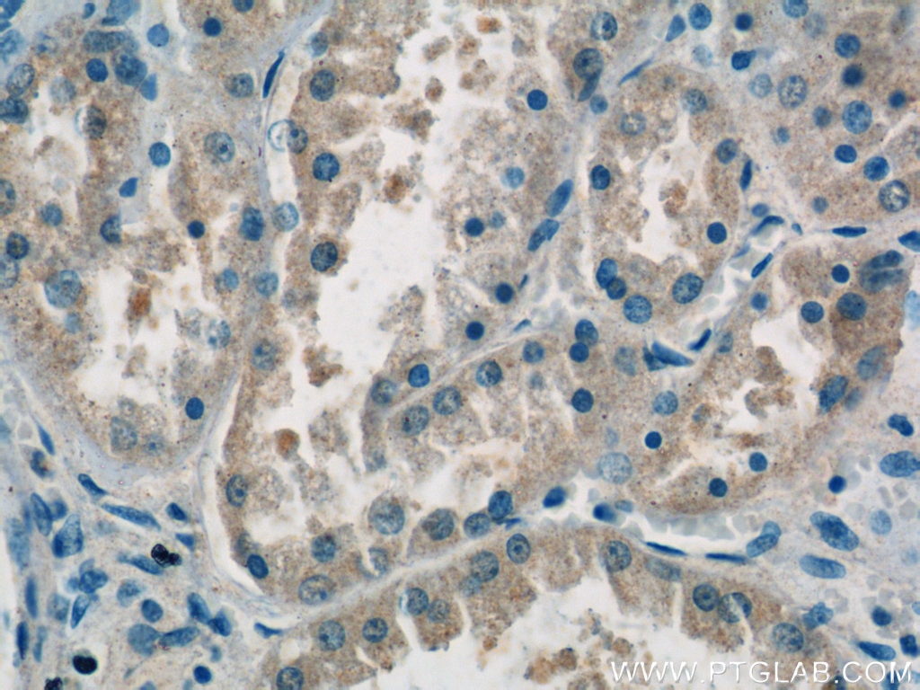 Immunohistochemistry (IHC) staining of human kidney tissue using domain-II-of-FIZ1 Polyclonal antibody (15827-1-AP)