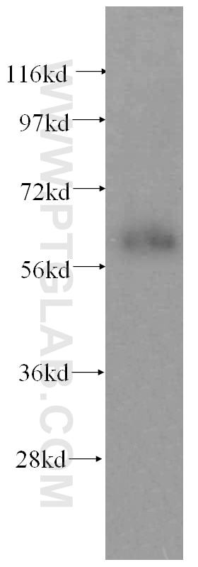 Western Blot (WB) analysis of human kidney tissue using domain-II-of-FIZ1 Polyclonal antibody (15827-1-AP)