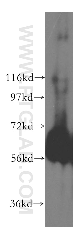 Western Blot (WB) analysis of human kidney tissue using domain-II-of-FIZ1 Polyclonal antibody (15827-1-AP)