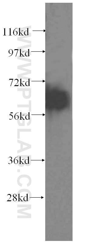 domain-II-of-FIZ1