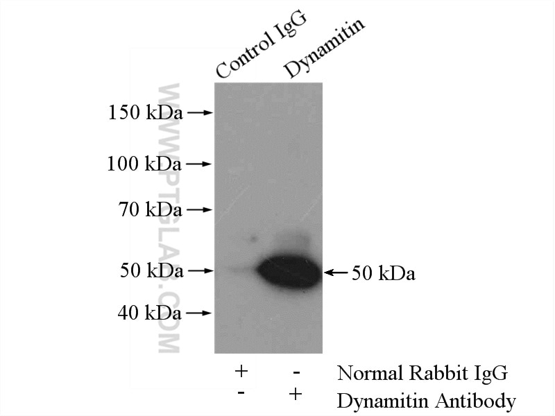 Immunoprecipitation (IP) experiment of mouse brain tissue using Dynamitin (69-376 AA) Polyclonal antibody (10030-2-AP)