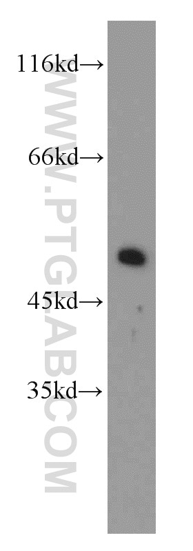 Western Blot (WB) analysis of mouse brain tissue using Dynamitin (69-376 AA) Polyclonal antibody (10030-2-AP)