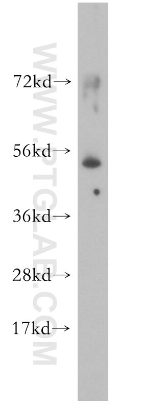 Western Blot (WB) analysis of human brain tissue using Dynamitin (69-376 AA) Polyclonal antibody (10030-2-AP)