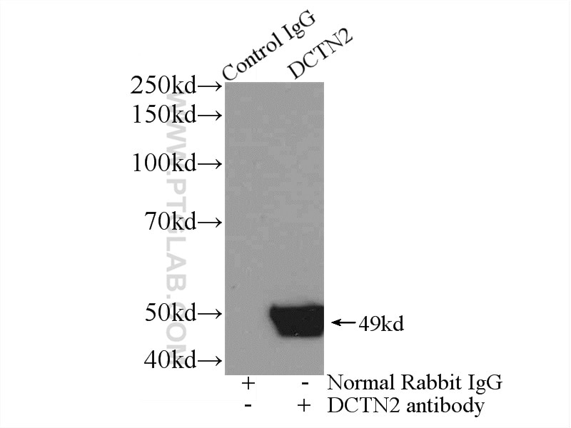 Immunoprecipitation (IP) experiment of mouse brain tissue using Dynamitin (1-83 AA) Polyclonal antibody (10031-2-AP)