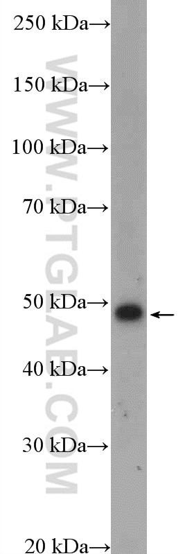 Western Blot (WB) analysis of mouse testis tissue using Dynamitin (1-83 AA) Polyclonal antibody (10031-2-AP)