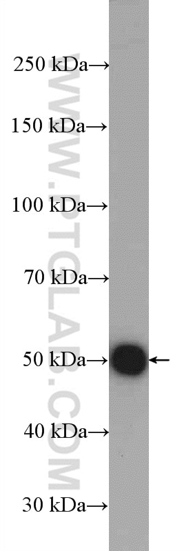 Western Blot (WB) analysis of mouse brain tissue using Dynamitin (1-83 AA) Polyclonal antibody (10031-2-AP)