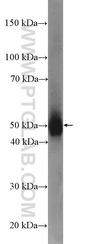 Western Blot (WB) analysis of human testis tissue using Dynamitin (1-83 AA) Polyclonal antibody (10031-2-AP)
