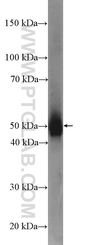 WB analysis of human testis using 10031-2-AP