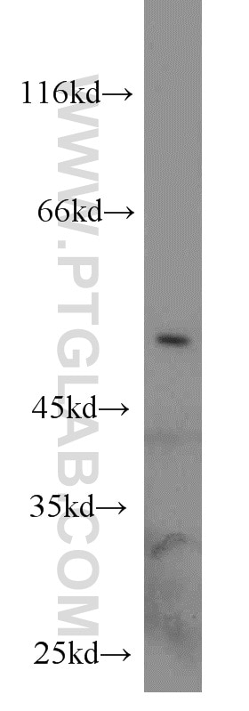 Dynamitin (1-83 AA)