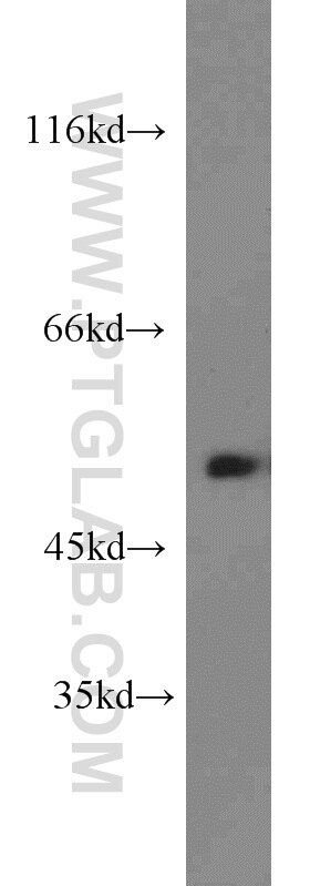 Western Blot (WB) analysis of mouse lung tissue using Dynamitin (1-83 AA) Polyclonal antibody (10031-2-AP)