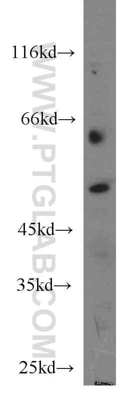Western Blot (WB) analysis of human testis tissue using Dynamitin (1-86 AA) Polyclonal antibody (10032-1-AP)