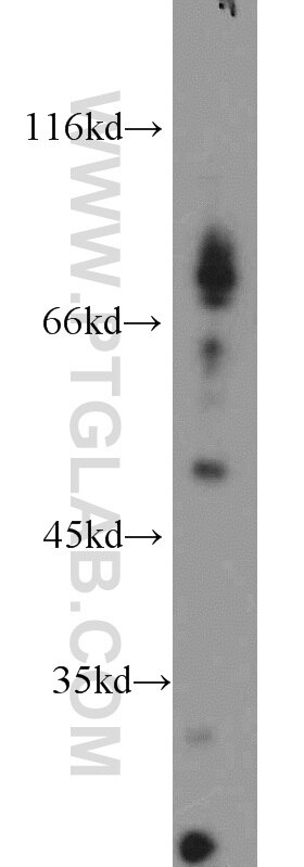 Western Blot (WB) analysis of human heart tissue using Dynamitin (1-86 AA) Polyclonal antibody (10032-1-AP)