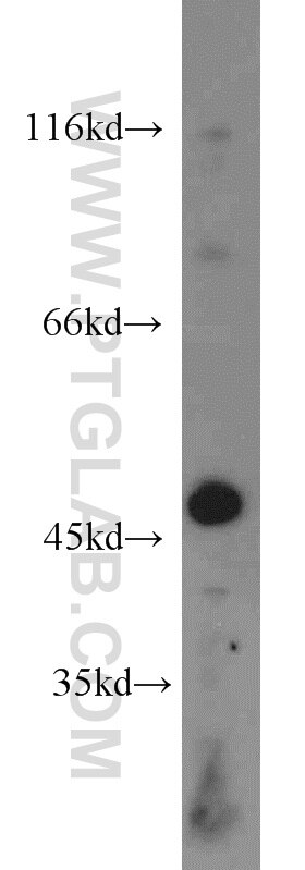 Western Blot (WB) analysis of human brain tissue using Dynamitin (1-86 AA) Polyclonal antibody (10032-1-AP)