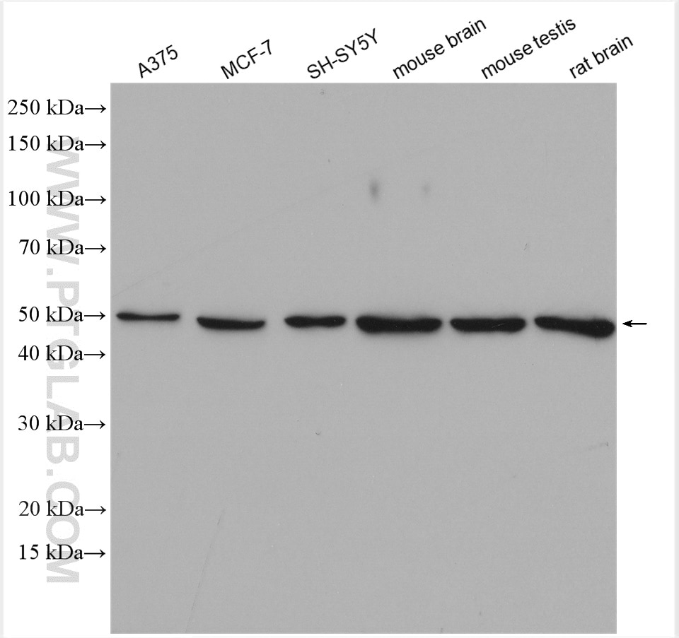 Western Blot (WB) analysis of various lysates using Dynamitin (1-401 AA) Polyclonal antibody (11361-1-AP)