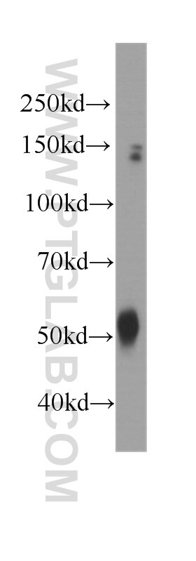 Western Blot (WB) analysis of human brain tissue using Dynamitin (1-401 AA) Monoclonal antibody (60257-1-Ig)