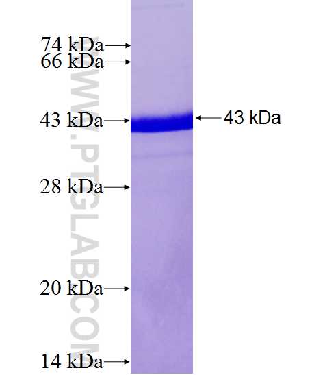 dynactin-2 fusion protein Ag0029 SDS-PAGE