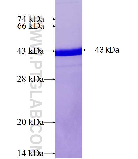 dynactin-2 fusion protein Ag0029 SDS-PAGE