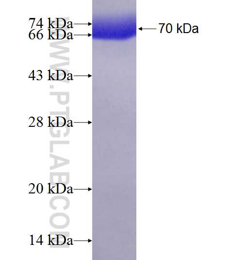 dynactin-2 fusion protein Ag1902 SDS-PAGE