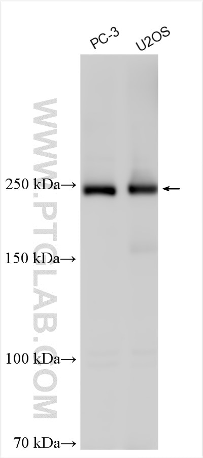 Western Blot (WB) analysis of various lysates using dysferlin Polyclonal antibody (31658-1-AP)