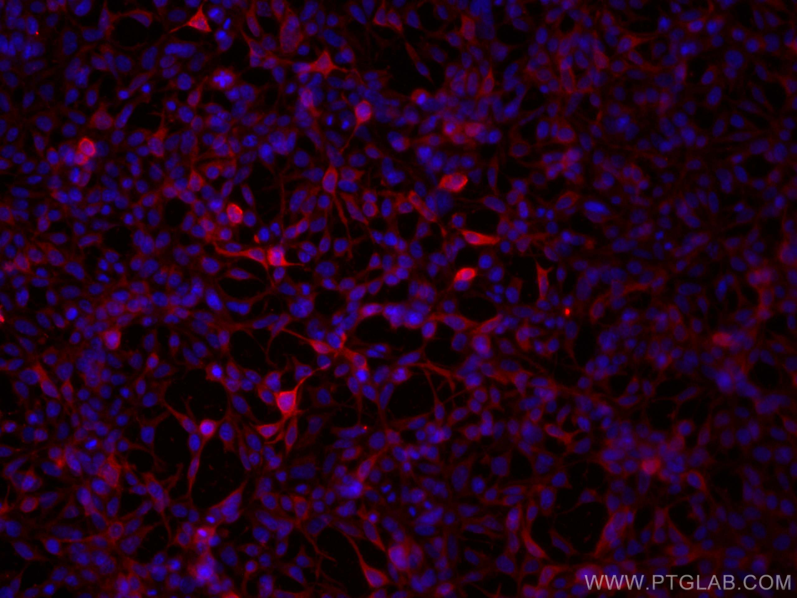 Immunofluorescence (IF) / fluorescent staining of Transfected HEK-293 cells using GFP tag Polyclonal antibody (50430-2-AP)