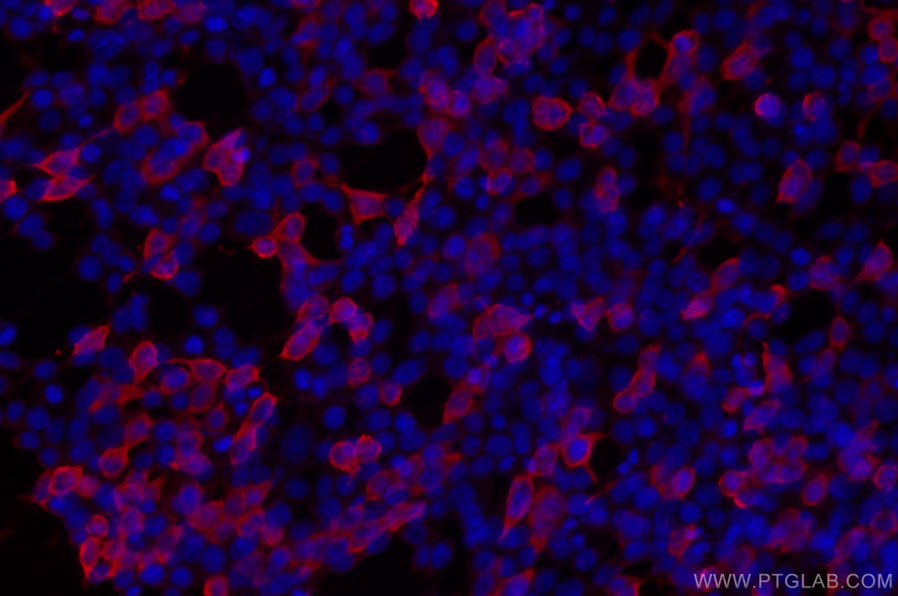 Immunofluorescence (IF) / fluorescent staining of Transfected HEK-293 cells using GFP tag Polyclonal antibody (50430-2-AP)