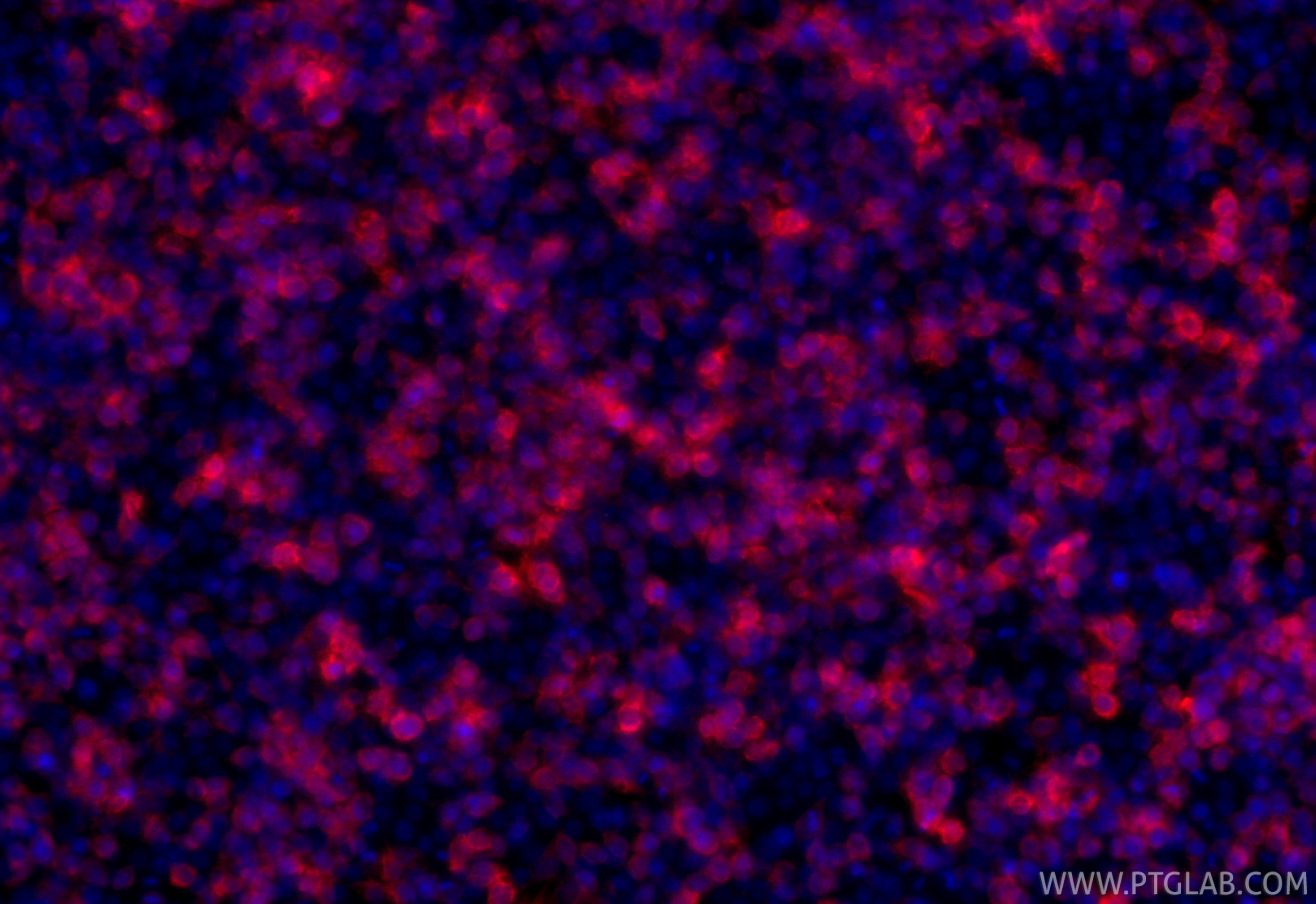 Immunofluorescence (IF) / fluorescent staining of Transfected HEK-293 cells using GFP tag Polyclonal antibody (50430-2-AP)