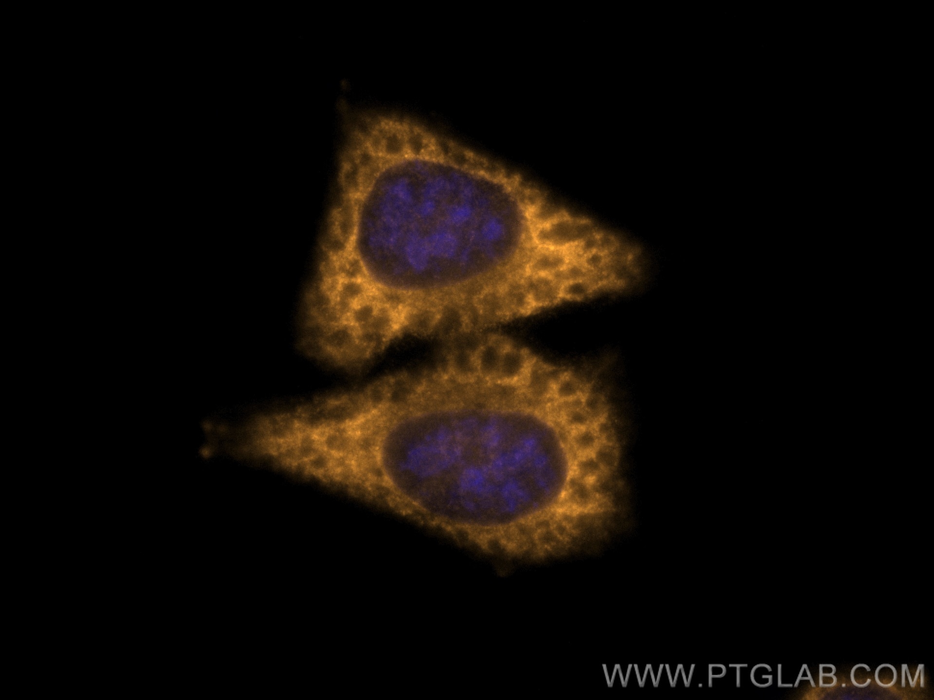 Immunofluorescence (IF) / fluorescent staining of HepG2 cells using CoraLite®555-conjugated eIF4G2/DAP5 Monoclonal ant (CL555-67428)