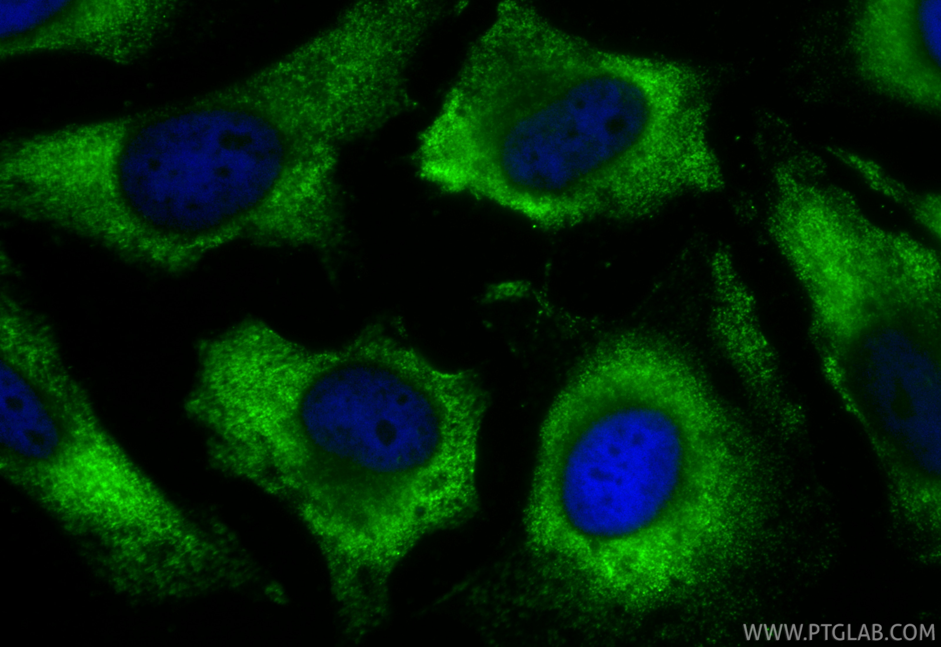 Immunofluorescent analysis of (-20°C Ethanol) fixed HeLa cells using CoraLite® Plus 488 eRF3a/GSPT1 antibody (CL488-68217, Clone: 2A3H6 ) at dilution of 1:200. Immunofluorescence (IF) / fluorescent staining of HeLa cells using CoraLite® Plus 488-conjugated eRF3a/GSPT1 Monoclon (CL488-68217)