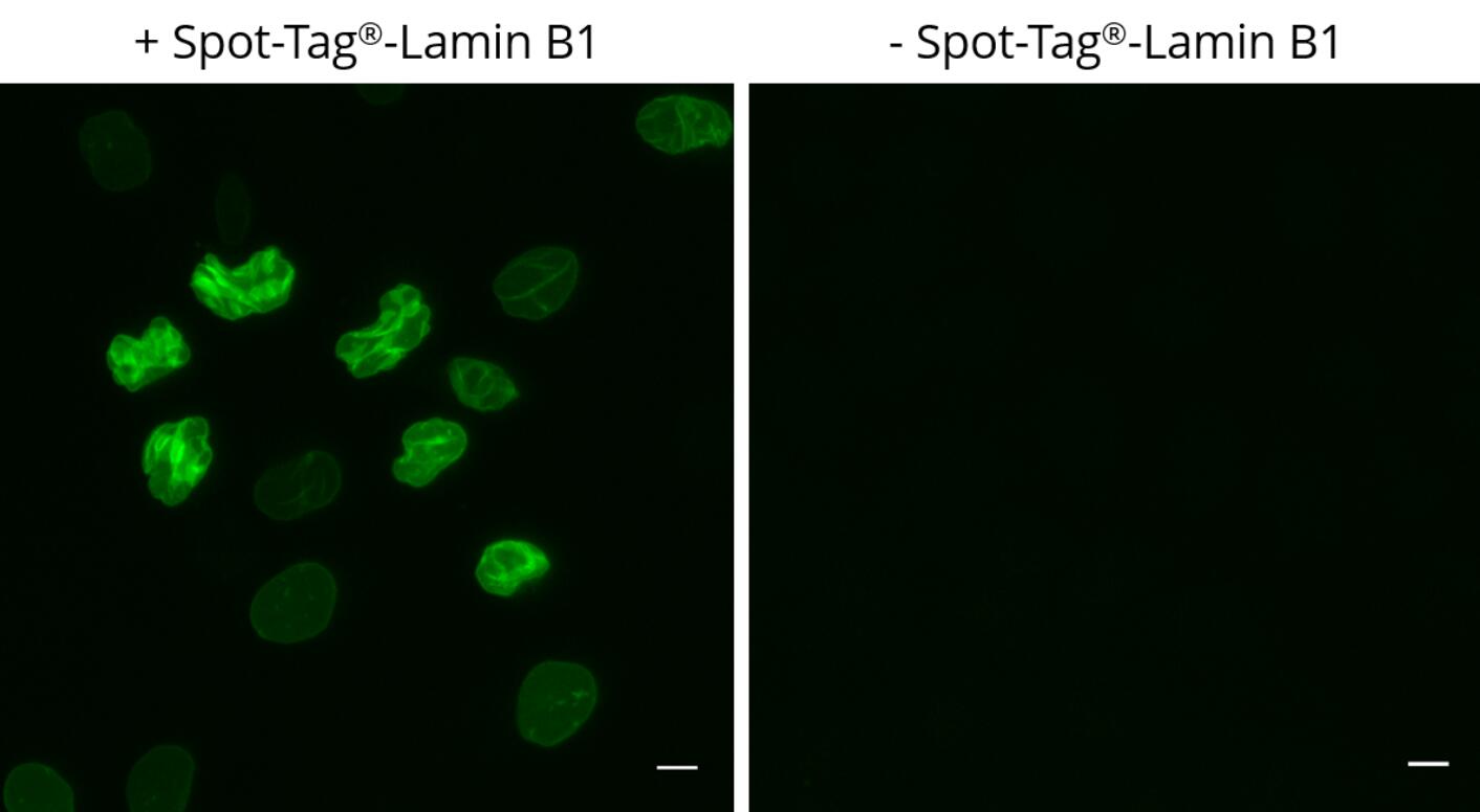 Left: HeLa cells transiently expressing Spot-Tag?-Lamin B1 were immunostained with Spot-Label? Alexa Fluor? 488 (ebAF488, 1:800). Right: Control staining of untransfected cells. Scale bar, 10 μm. Images were acquired with the Thermo Scientific CellInsight CX7, 20X objective
