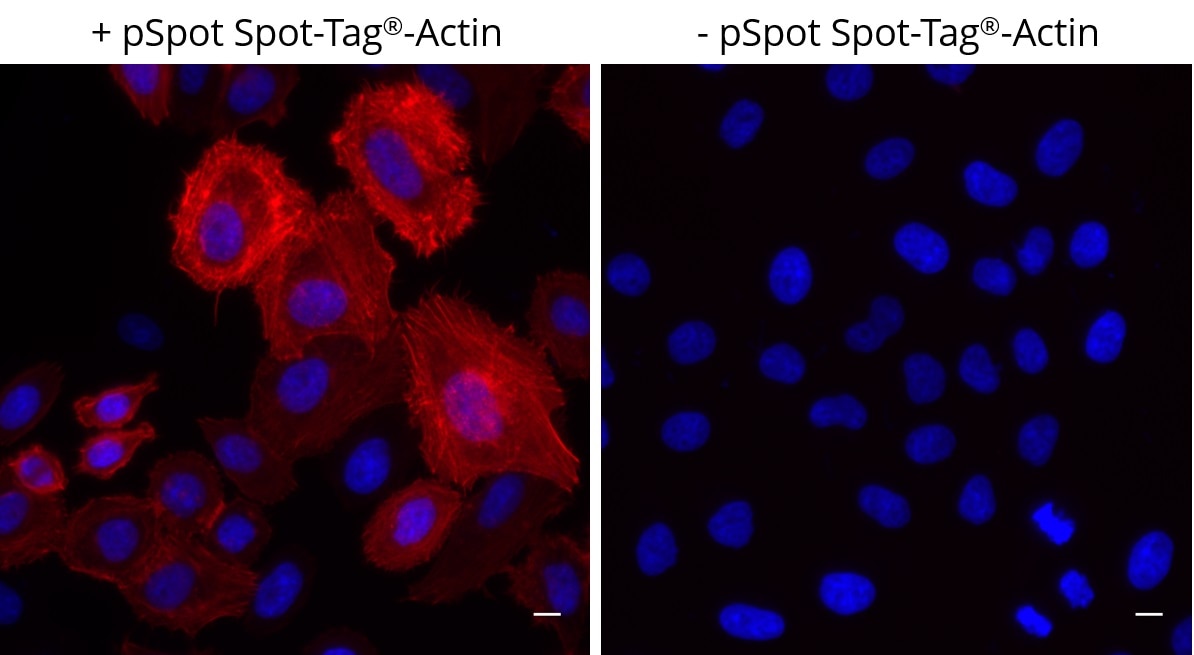 Left: HeLa cells transiently expressing pSpot Spot-Tag?-Actin (ev-31) were immunostained with Spot-Label? Alexa Fluor? 568 (red, ebAF568, 1:800) and DAPI (blue). Right: Control staining with Spot-Label? Alexa Fluor? 568 (red, ebAF568, 1:800) and DAPI (blue) of untransfected HeLa cells showing no unspecific background. Scale bar, 10 μm. Images were acquired with the Thermo Scientific CellInsight CX7, 20X objective.