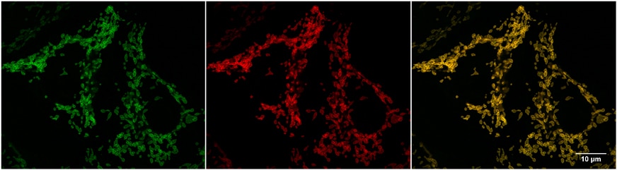 Widefield images of HeLa cells expressing Tom70-EGFP-Spot-Tag immunostained with Spot-Label ATTO594, bivalent (1:5,000). Left: GFP channel, middle: channel for ATTO594, right: overlay, also with DAPI. Scale bar, 10 μm.