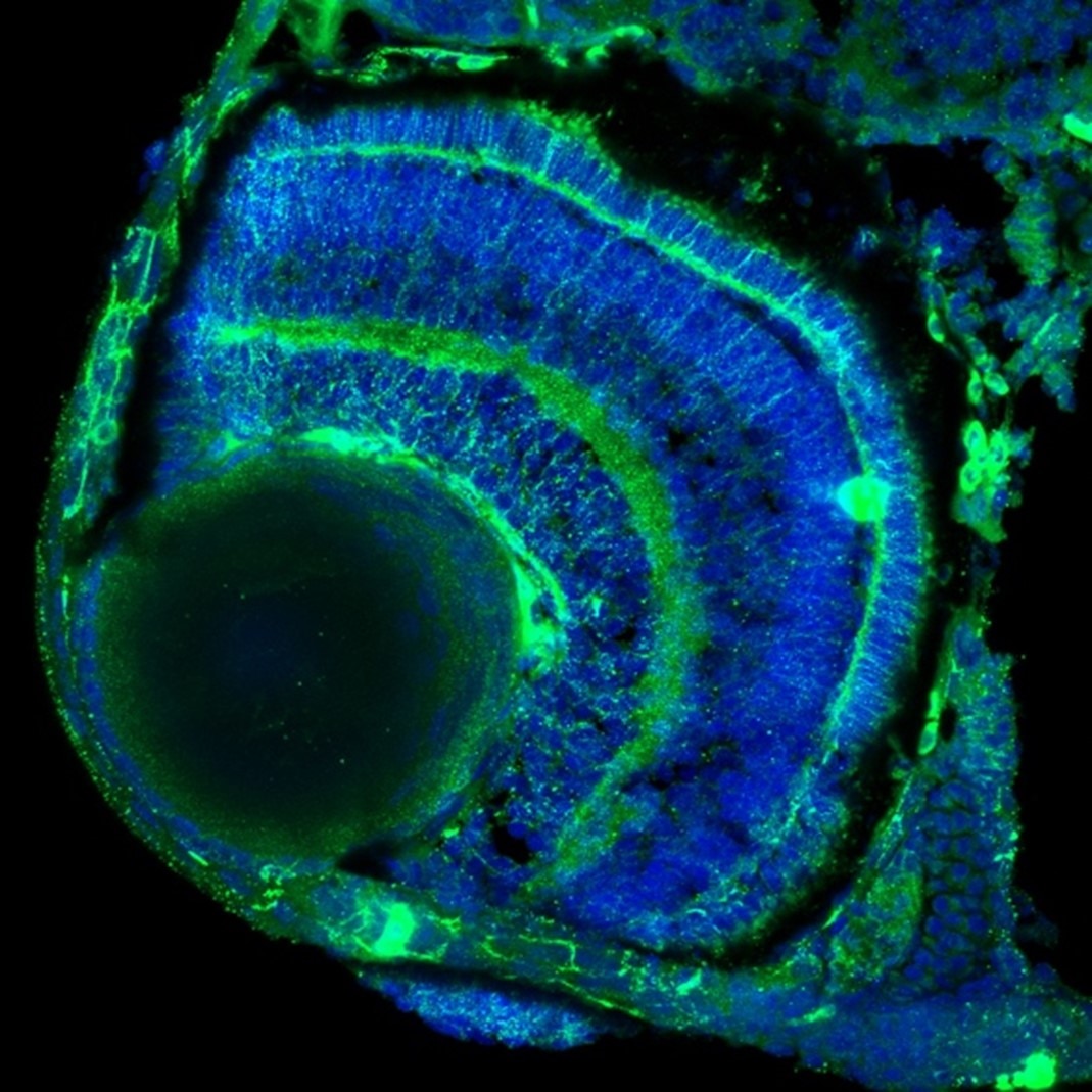 IF Staining of zebrafish retina using 18301-1-AP