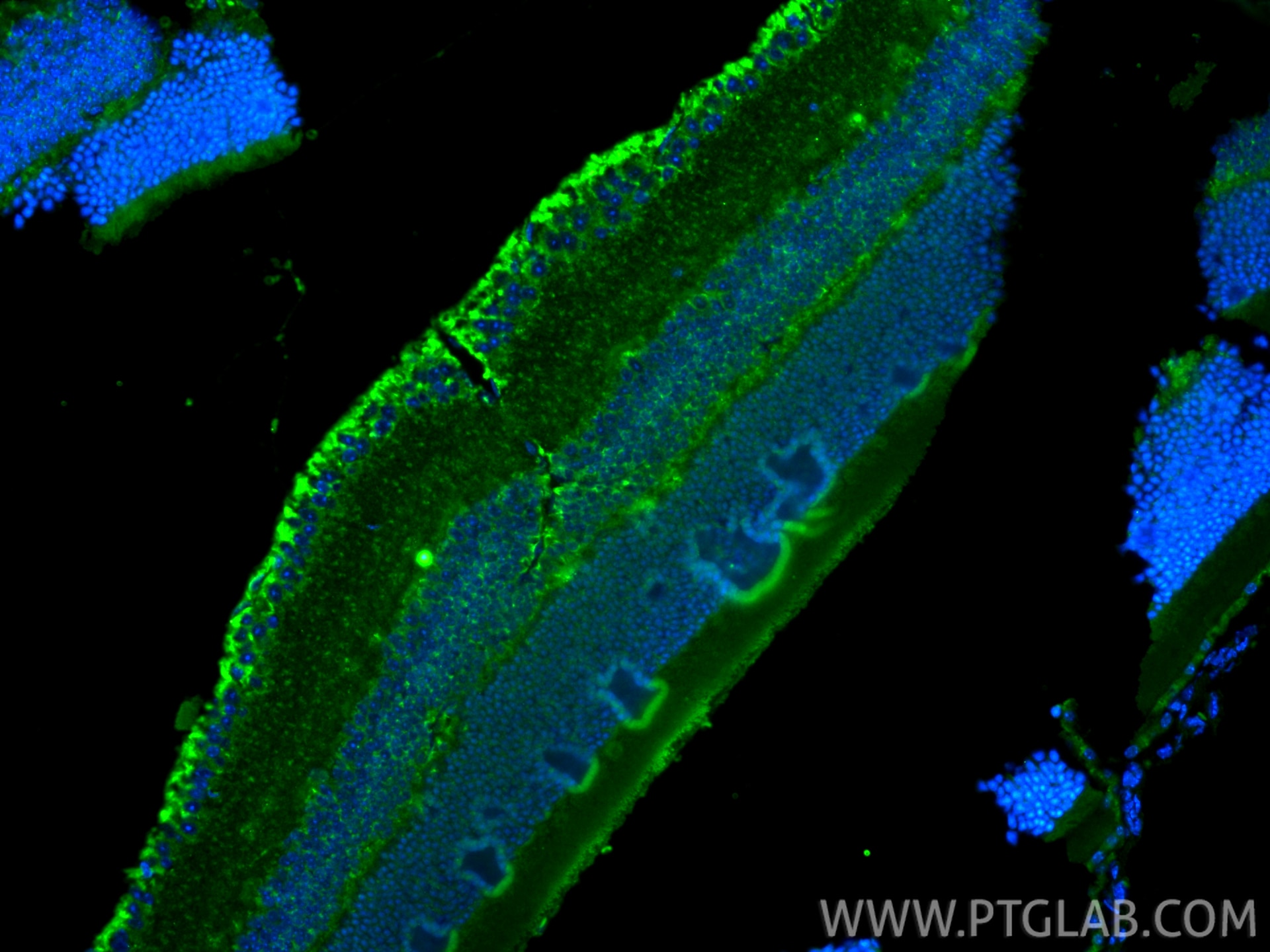 Immunofluorescence (IF) / fluorescent staining of mouse eye tissue using Collagen Type XVIII Polyclonal antibody (18301-1-AP)