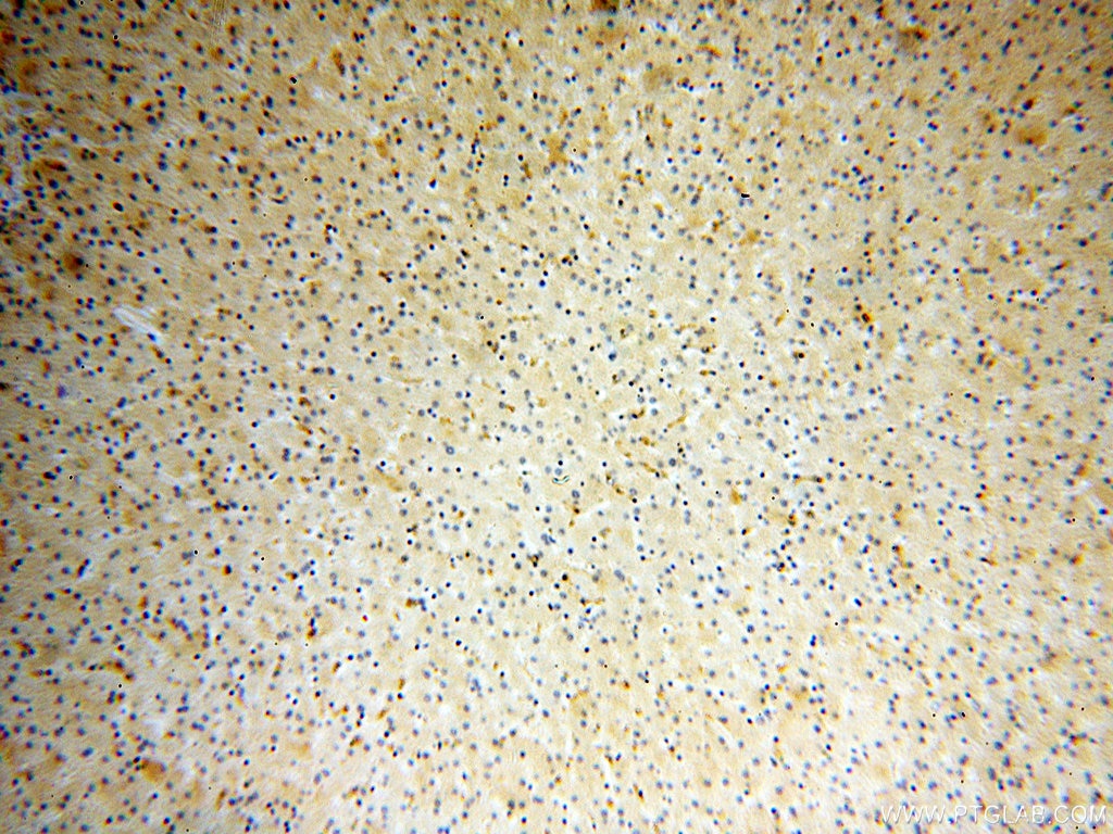Immunohistochemistry (IHC) staining of human liver tissue using Endostatin Polyclonal antibody (18301-1-AP)