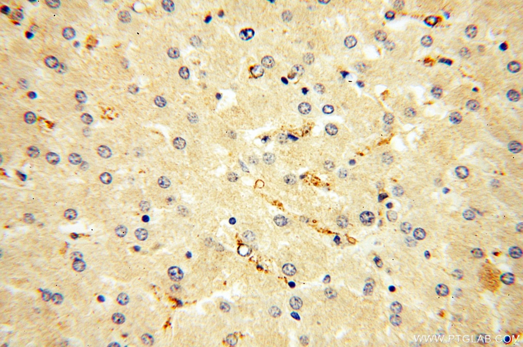 IHC staining of human liver using 18301-1-AP