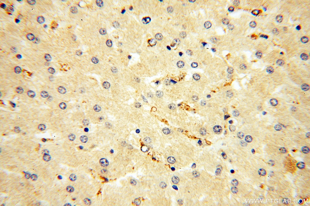 Immunohistochemistry (IHC) staining of human liver tissue using Endostatin Polyclonal antibody (18301-1-AP)