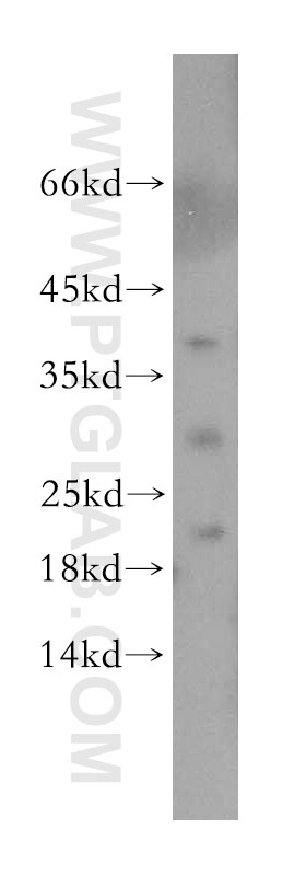 Western Blot (WB) analysis of human liver tissue using Endostatin Polyclonal antibody (18301-1-AP)