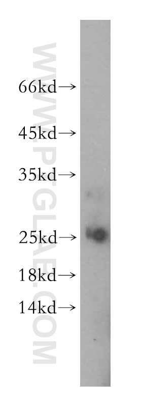 Western Blot (WB) analysis of human kidney tissue using Endostatin Polyclonal antibody (18301-1-AP)